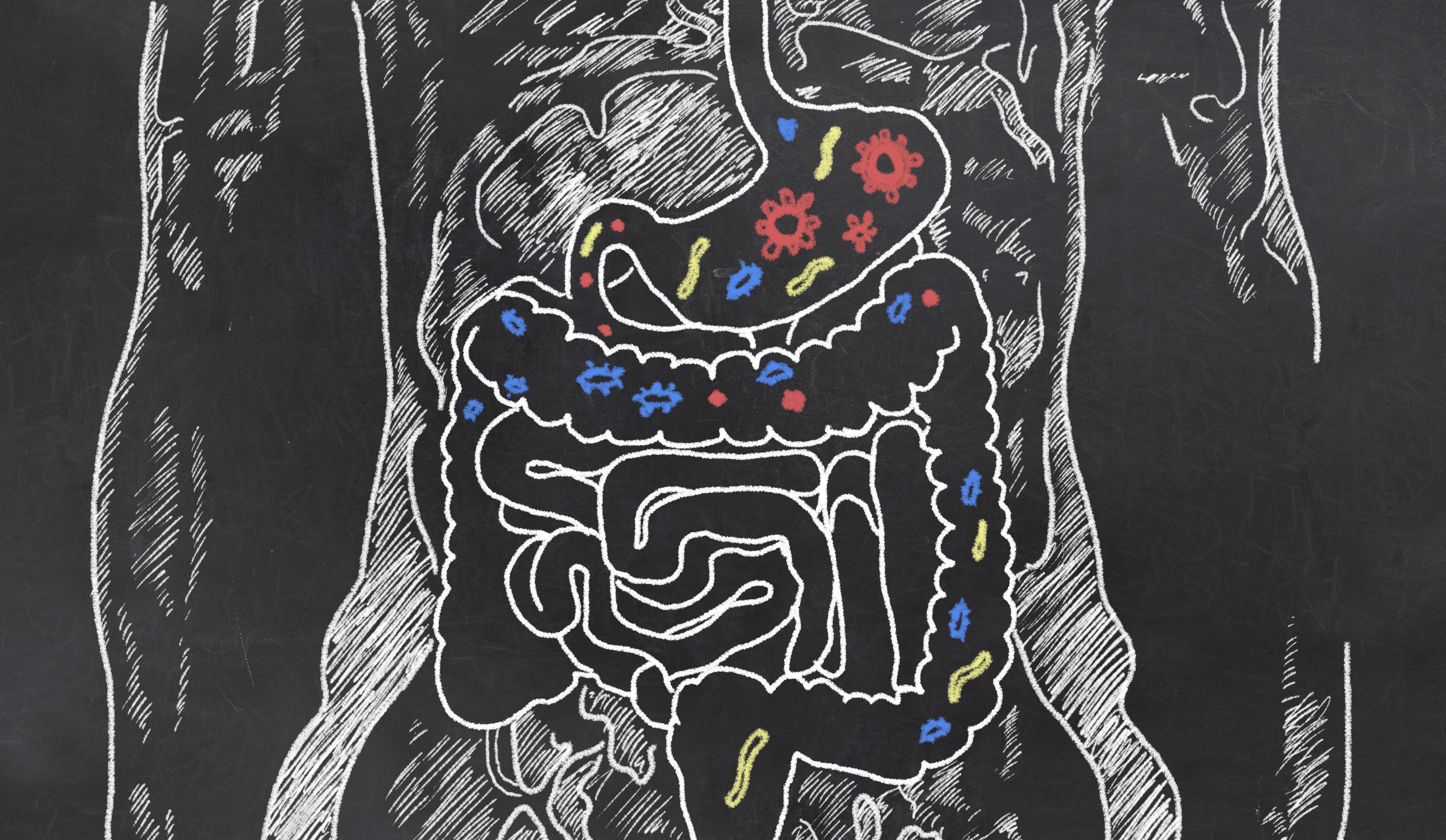 Gut Feeling: Can What You Eat Affect Your Colon Cancer Risk? The food environment, microbial cysteine metabolism, and cancer disparities