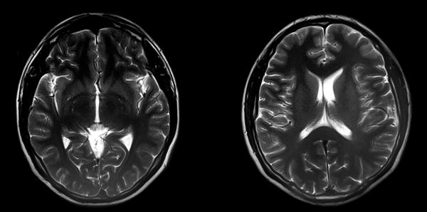  Ever Wonder How We Process Pain? Join Our Study! 